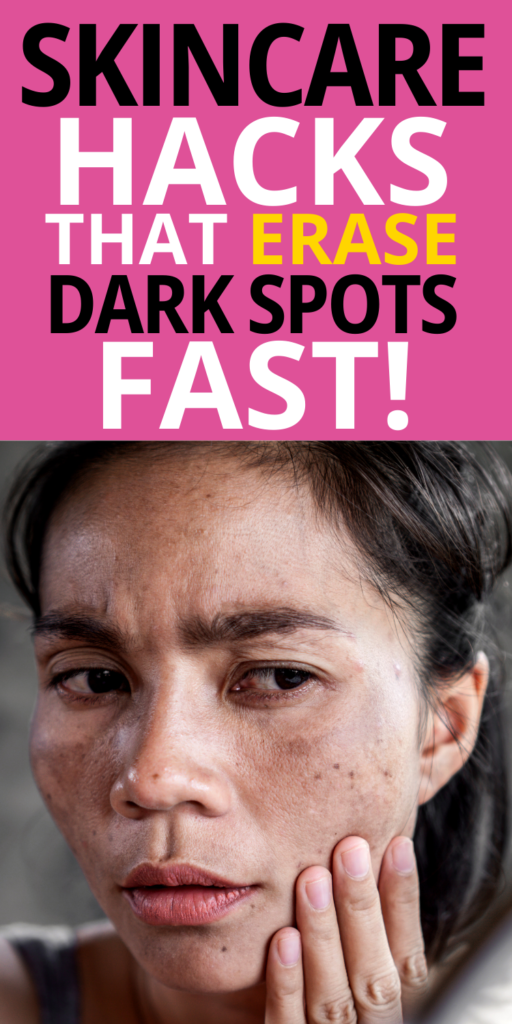 Skincare Hacks That Erase Dark Spots Fast!