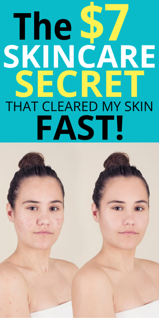 The $7 Skincare Secret That Cleared My Skin Fast